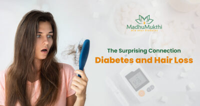 diabetes and hair loss